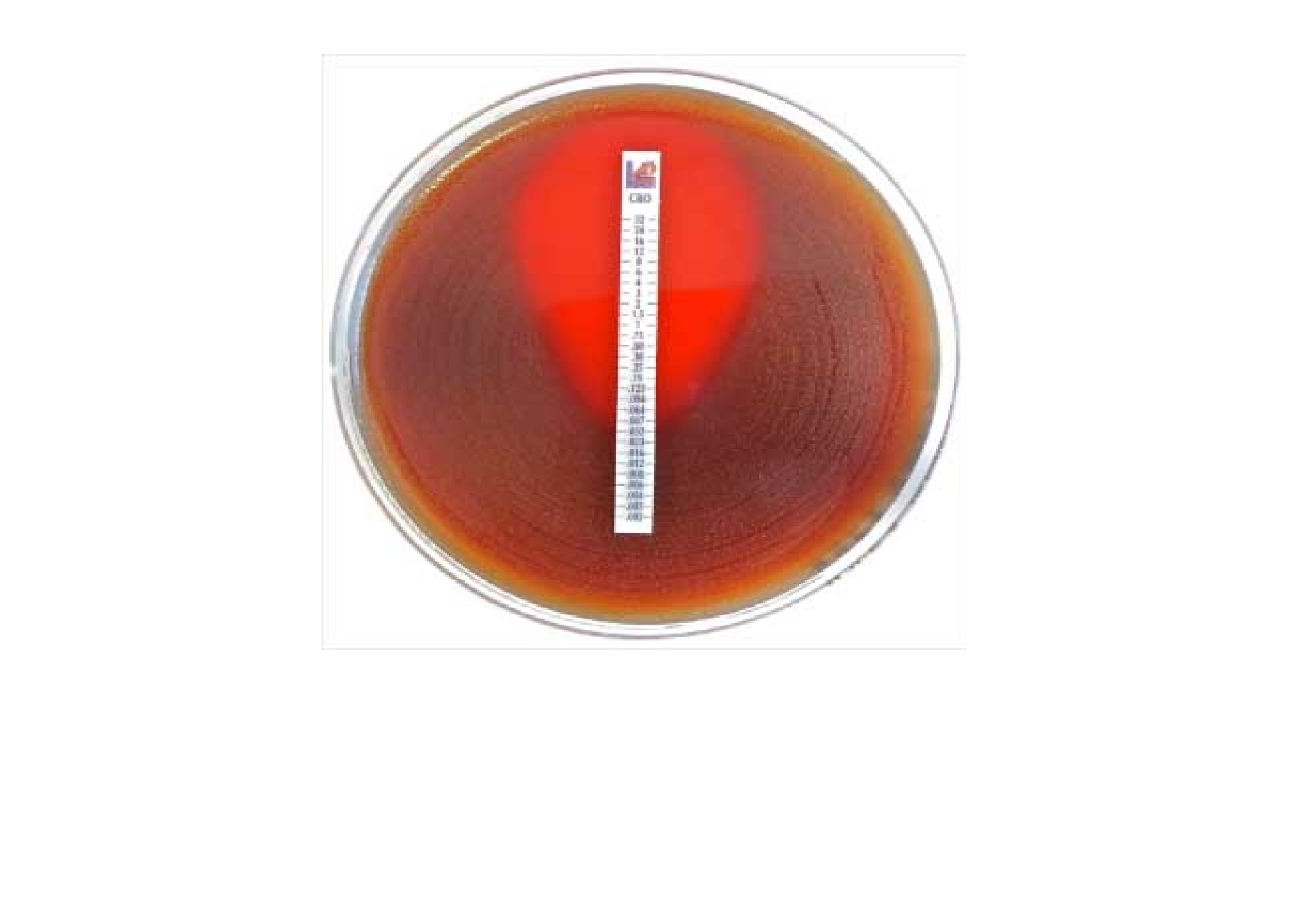 Antimicrobial Susceptibility Testing